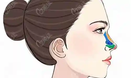 阵容过的鼻子透明
