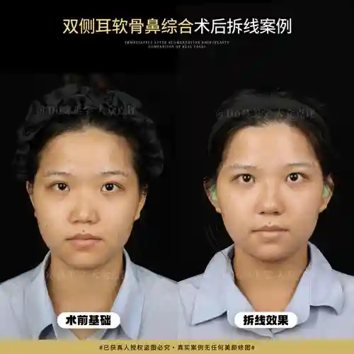 深圳整容阵容插图1