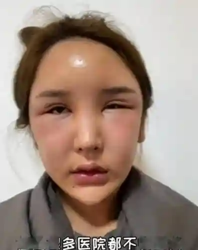 阵容失败脸插图1